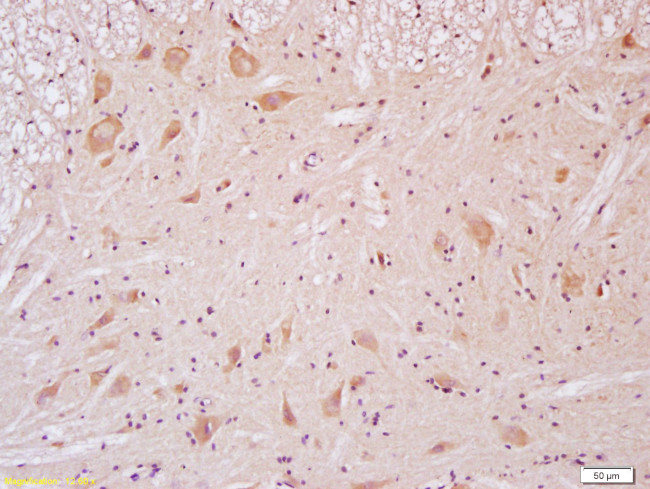 NMDAR2B Antibody in Immunohistochemistry (Paraffin) (IHC (P))