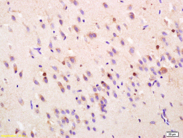 FGF1 Antibody in Immunohistochemistry (Paraffin) (IHC (P))