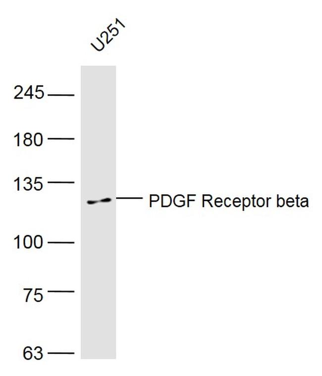 PDGF Receptor beta Antibody in Western Blot (WB)
