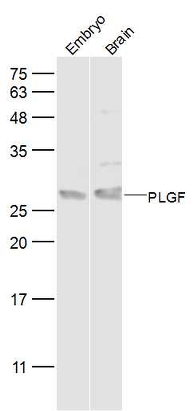 PLGF Antibody in Western Blot (WB)