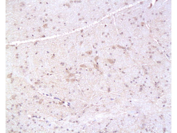 PMP22 Antibody in Immunohistochemistry (Paraffin) (IHC (P))