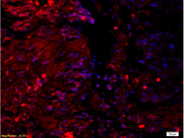 14-3-3 Alpha/Beta/Gamma/Delta/Epsilon Antibody in Immunohistochemistry (Paraffin) (IHC (P))