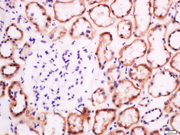 EphB2 R Antibody in Immunohistochemistry (Paraffin) (IHC (P))