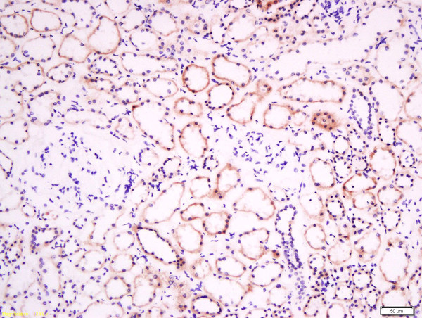 EphB2 R Antibody in Immunohistochemistry (Paraffin) (IHC (P))