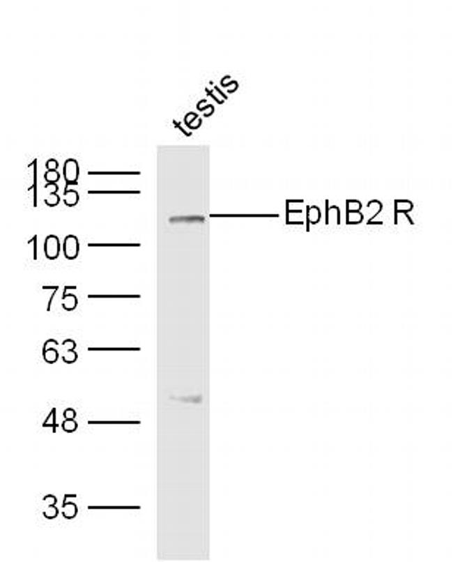 EphB2 R Antibody in Western Blot (WB)