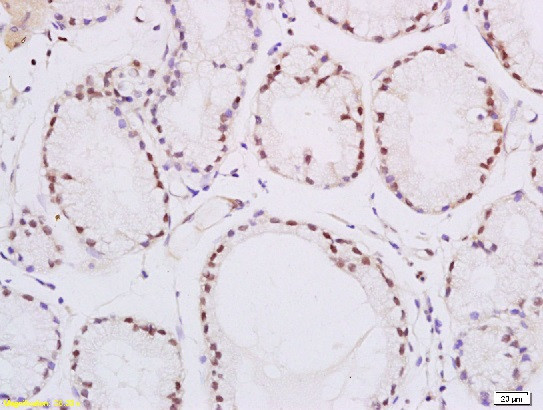 PPAR delta Antibody in Immunohistochemistry (Paraffin) (IHC (P))