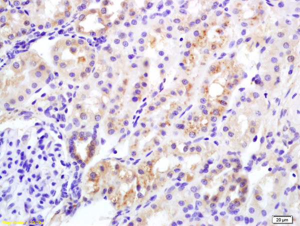 Insulin Receptor Alpha Antibody in Immunohistochemistry (Paraffin) (IHC (P))