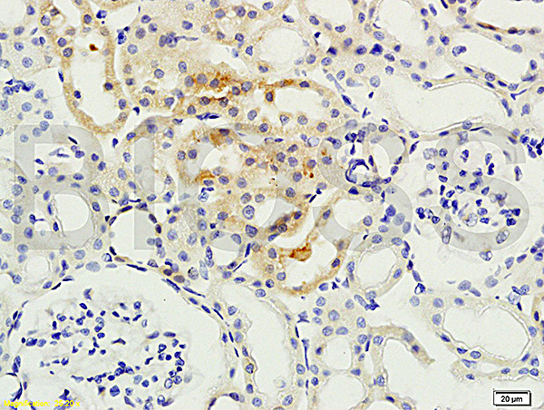 PKC beta Antibody in Immunohistochemistry (Paraffin) (IHC (P))