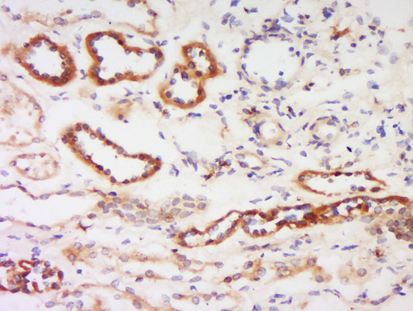 PKC beta Antibody in Immunohistochemistry (Paraffin) (IHC (P))