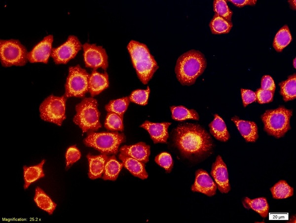 VEGF Antibody in Immunocytochemistry (ICC/IF)