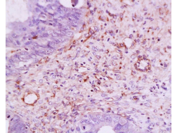 VEGF Antibody in Immunohistochemistry (Paraffin) (IHC (P))