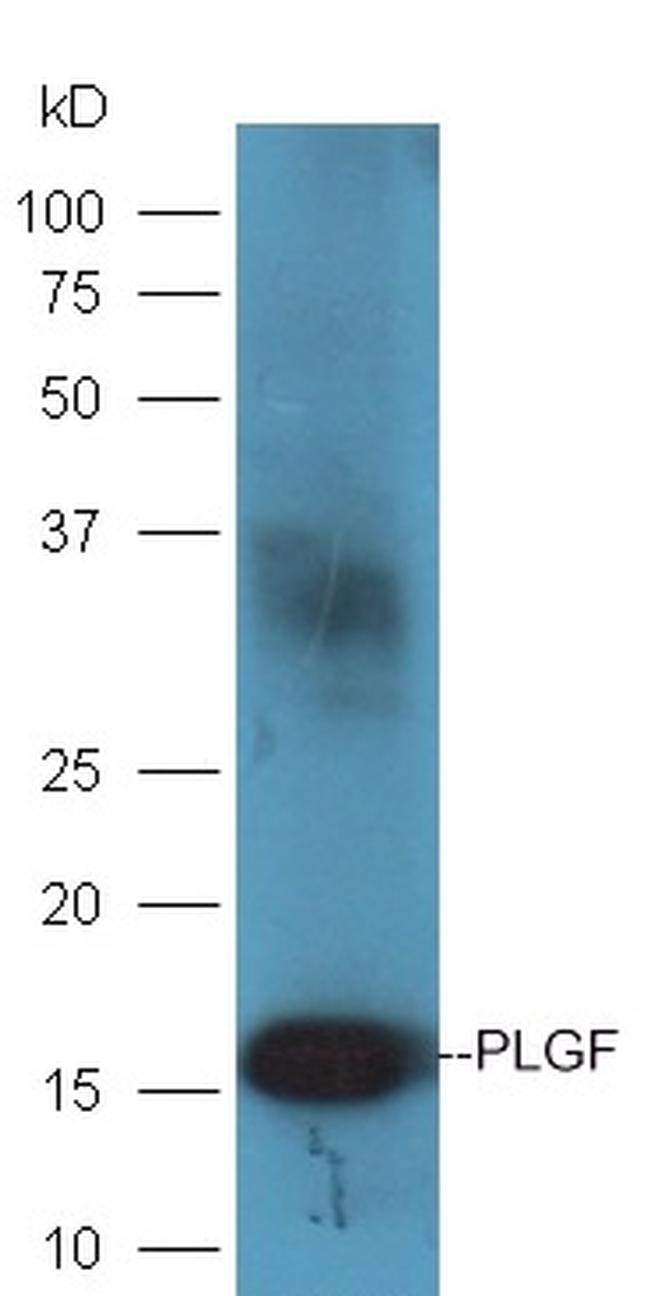 PLGF Antibody in Western Blot (WB)