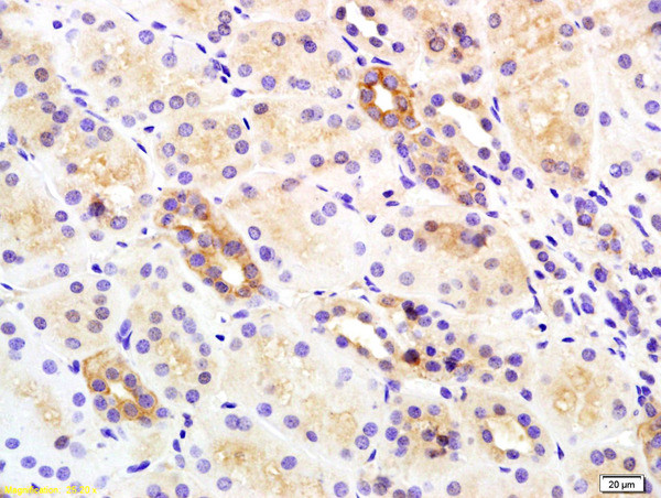 Insulin Receptor Beta Antibody in Immunohistochemistry (Paraffin) (IHC (P))