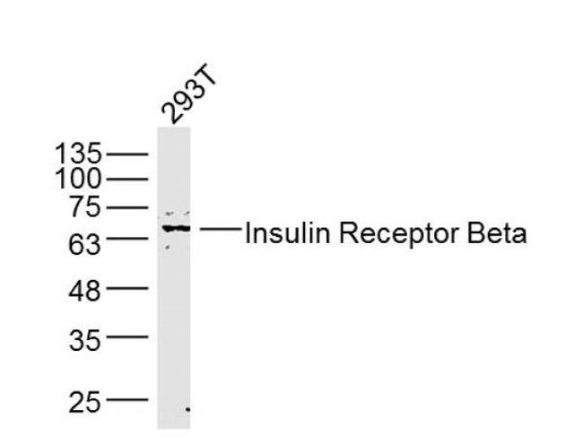 Insulin Receptor Beta Antibody in Western Blot (WB)