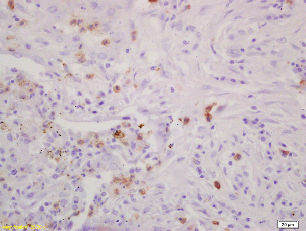 IGBP1 Antibody in Immunohistochemistry (Paraffin) (IHC (P))