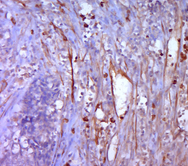 Mesothelin Antibody in Immunohistochemistry (Paraffin) (IHC (P))