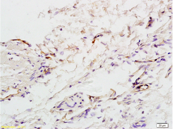 factor 8/F8 Antibody in Immunohistochemistry (Paraffin) (IHC (P))