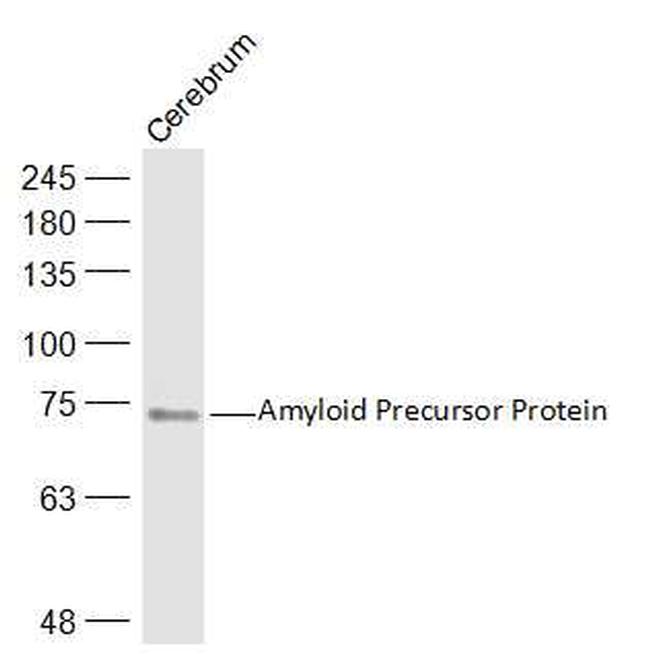 Amyloid Precursor Protein Antibody in Western Blot (WB)