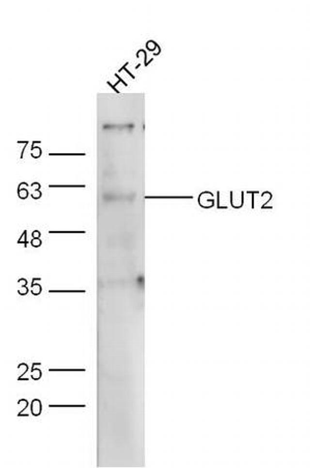 GLUT2 Antibody in Western Blot (WB)