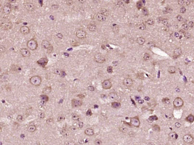 CRF Antibody in Immunohistochemistry (Paraffin) (IHC (P))