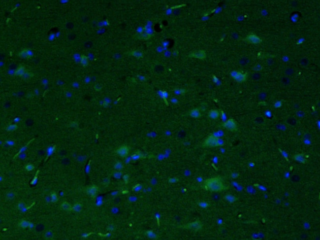 CRF Antibody in Immunohistochemistry (Paraffin) (IHC (P))