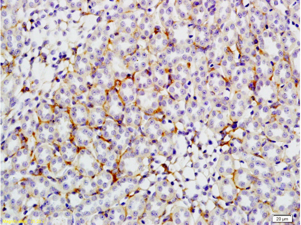 GLUT4 Antibody in Immunohistochemistry (Paraffin) (IHC (P))