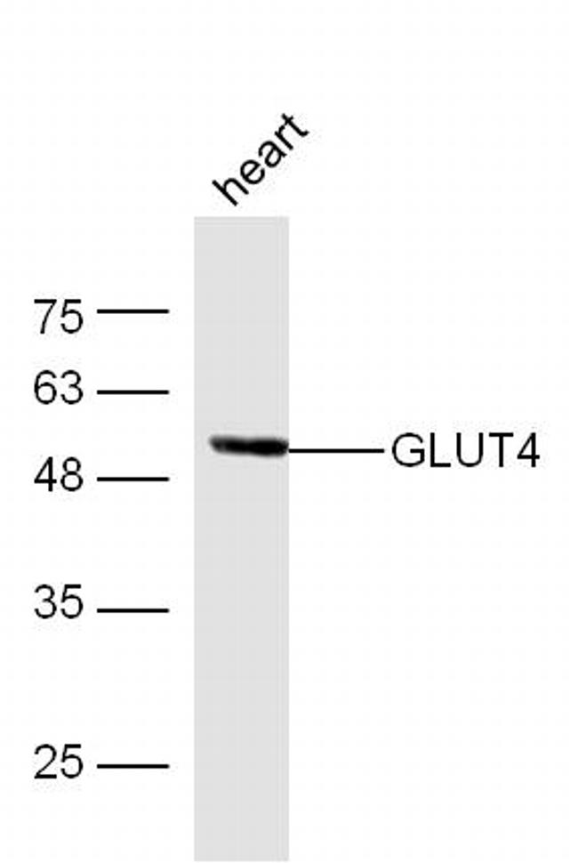 GLUT4 Antibody in Western Blot (WB)