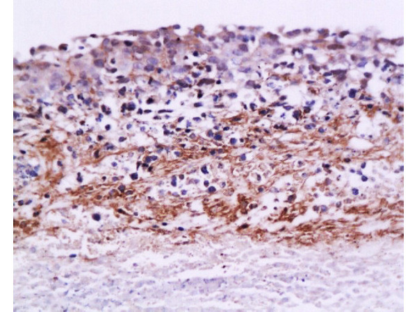 MMP9 Antibody in Immunohistochemistry (Paraffin) (IHC (P))