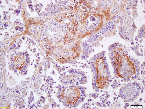 MMP9 Antibody in Immunohistochemistry (Paraffin) (IHC (P))