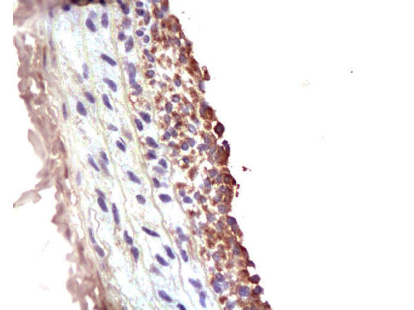 MMP2 Antibody in Immunohistochemistry (Paraffin) (IHC (P))