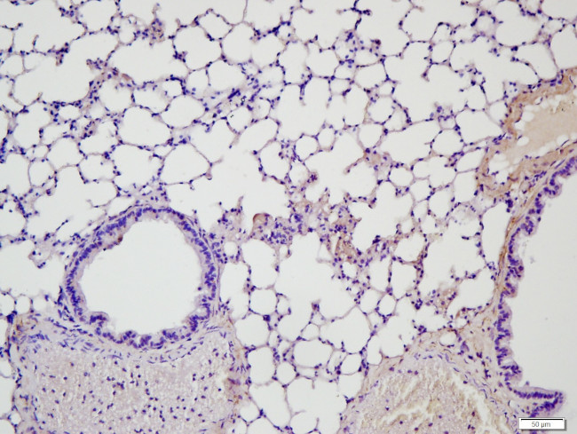 MMP2 Antibody in Immunohistochemistry (Paraffin) (IHC (P))