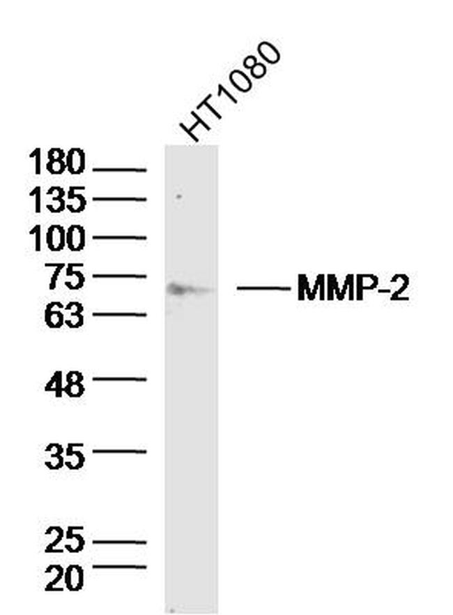 MMP2 Antibody in Western Blot (WB)