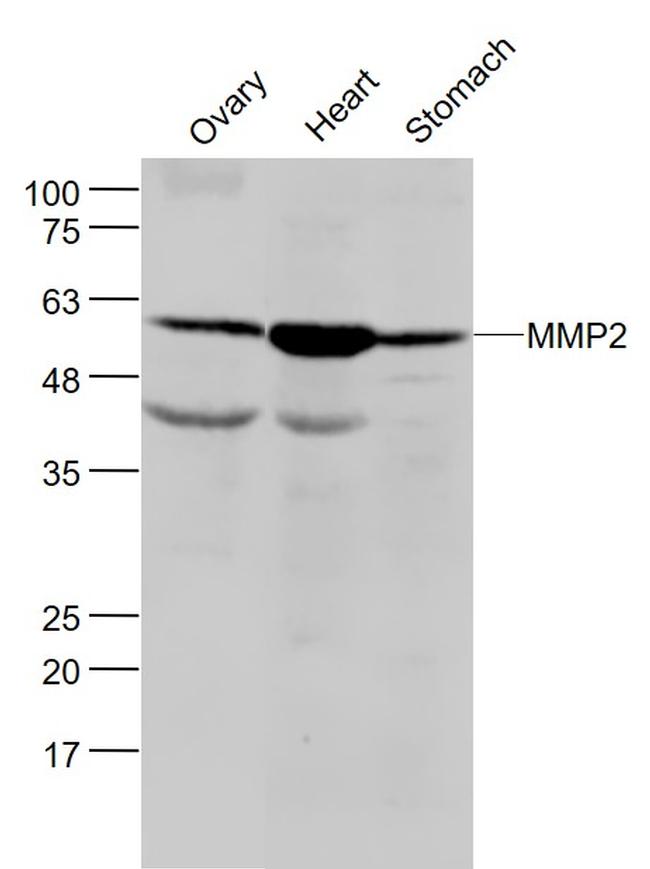 MMP2 Antibody in Western Blot (WB)