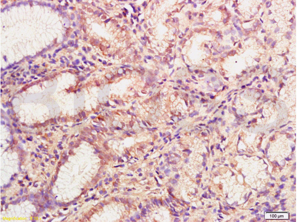 MMP-3 Antibody in Immunohistochemistry (Paraffin) (IHC (P))