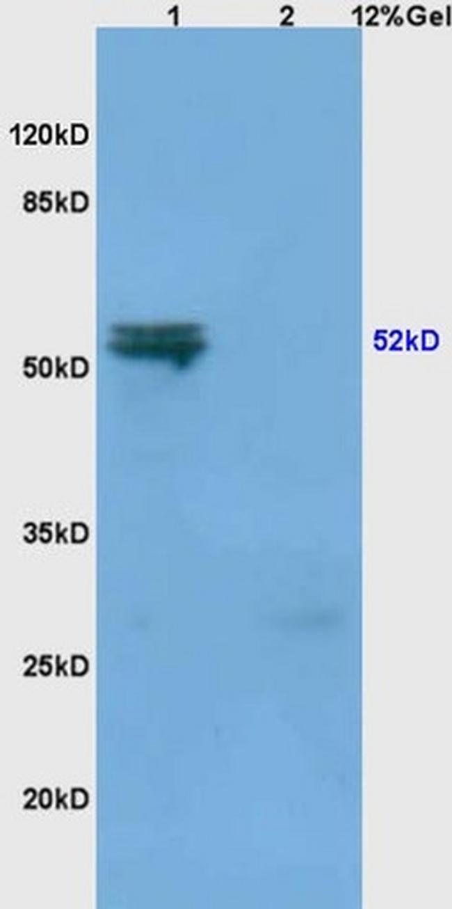 MMP-3 Antibody in Western Blot (WB)