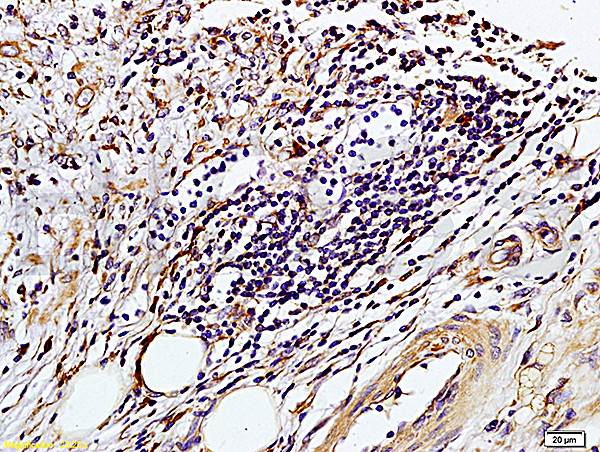 TIMP-1 Antibody in Immunohistochemistry (Paraffin) (IHC (P))