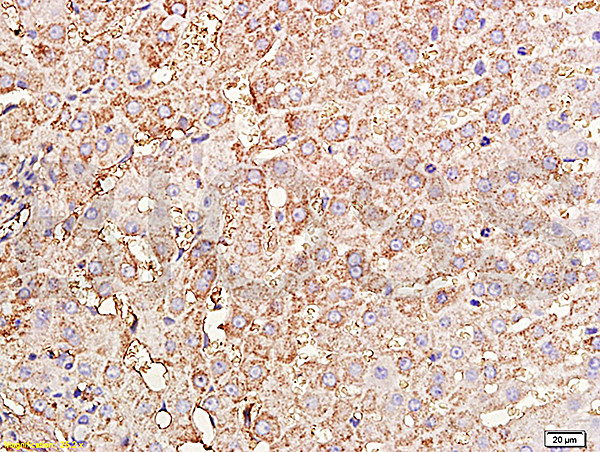 TIMP-1 Antibody in Immunohistochemistry (Paraffin) (IHC (P))