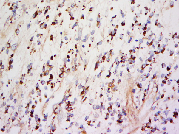 TIMP-1 Antibody in Immunohistochemistry (Paraffin) (IHC (P))