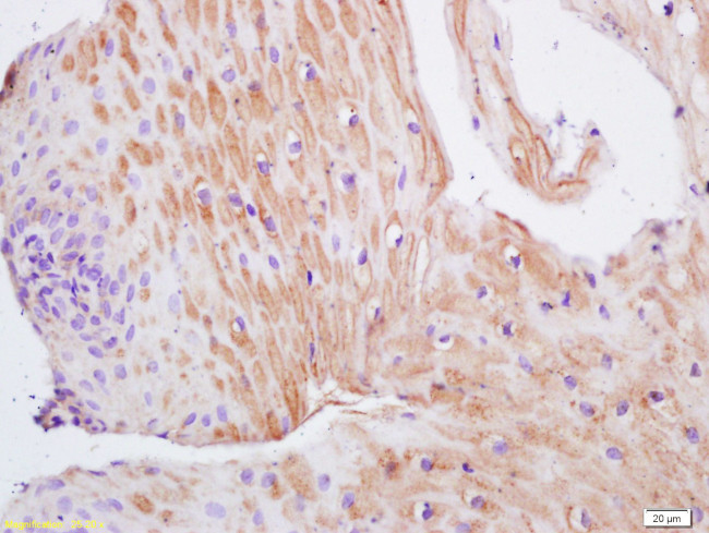 TIMP-1 Antibody in Immunohistochemistry (Paraffin) (IHC (P))