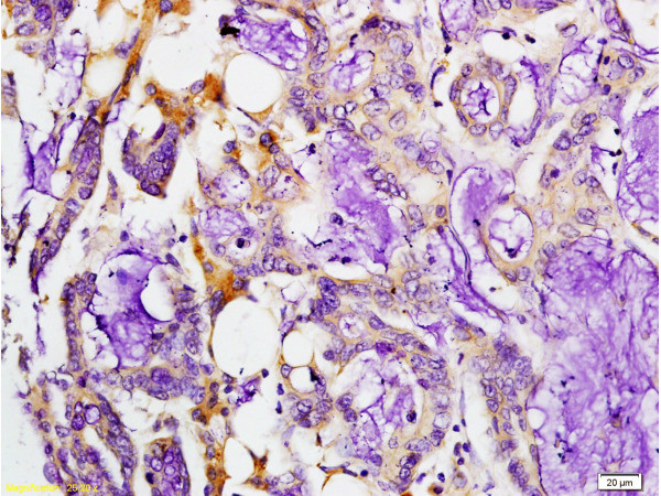 MMP-7 Antibody in Immunohistochemistry (Paraffin) (IHC (P))