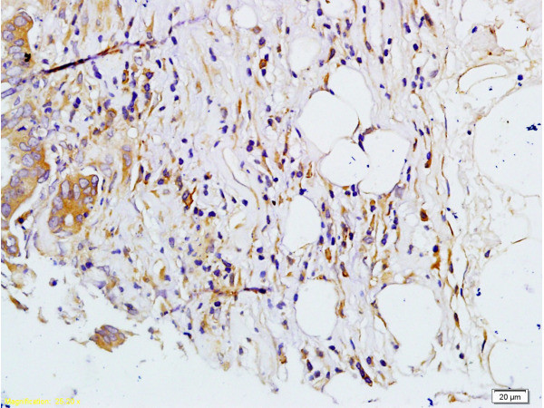 MMP-7 Antibody in Immunohistochemistry (Paraffin) (IHC (P))