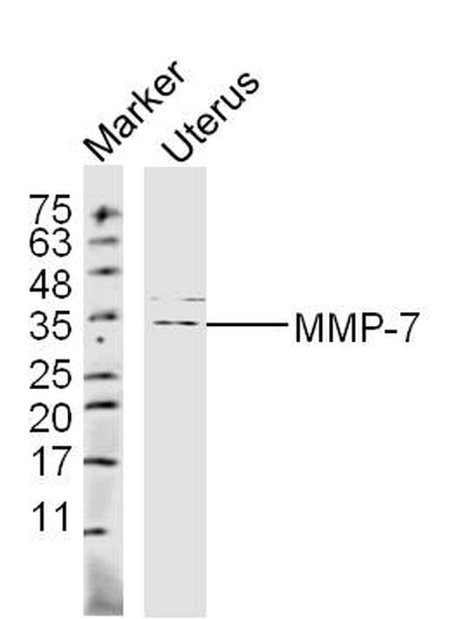 MMP-7 Antibody in Western Blot (WB)