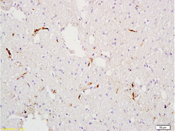 Factor 8 Antibody in Immunohistochemistry (Paraffin) (IHC (P))