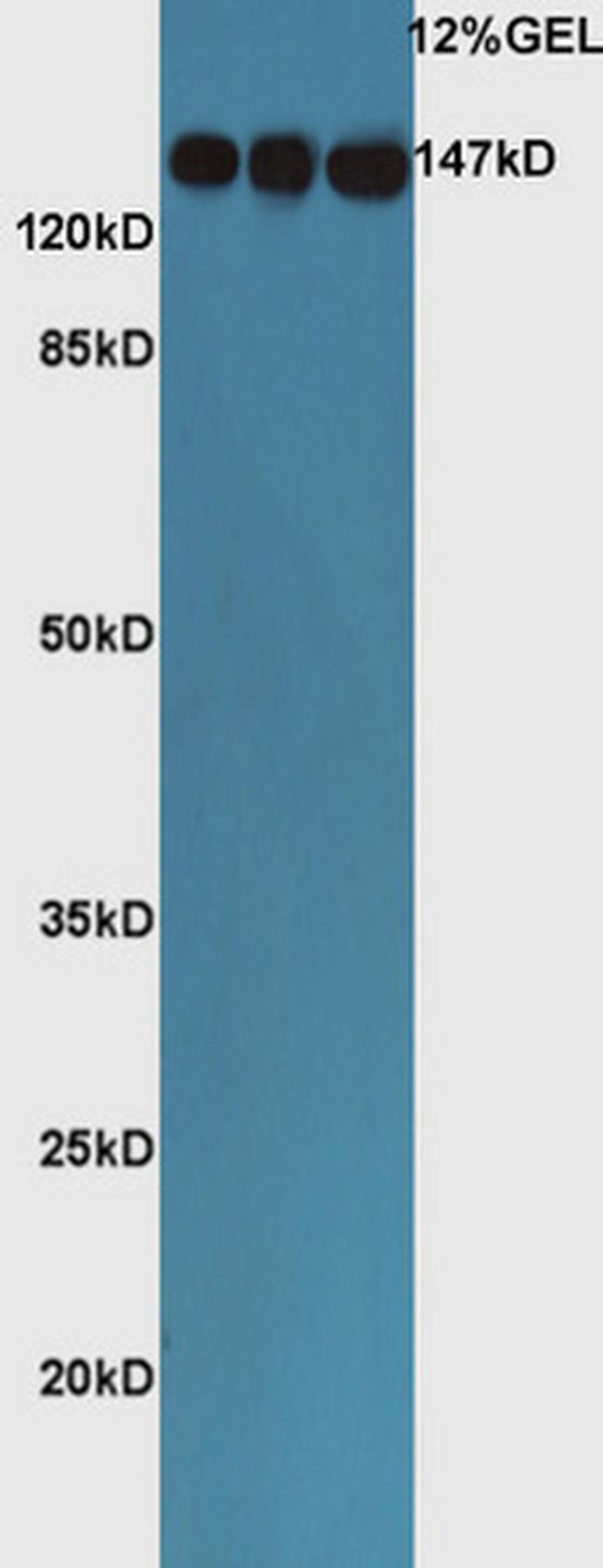 ACE Antibody in Western Blot (WB)