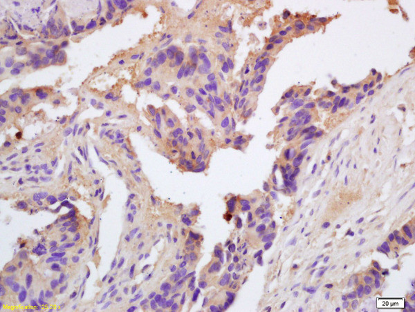 ChRM2 Antibody in Immunohistochemistry (Paraffin) (IHC (P))