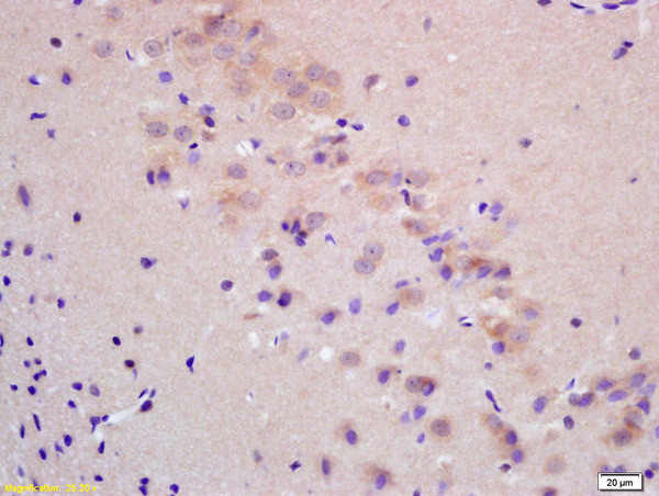 ChRM2 Antibody in Immunohistochemistry (Paraffin) (IHC (P))