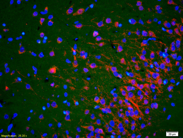 ACTH 18-39 Antibody in Immunohistochemistry (Paraffin) (IHC (P))