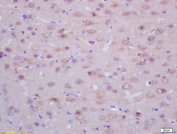 ACTH 18-39 Antibody in Immunohistochemistry (Paraffin) (IHC (P))