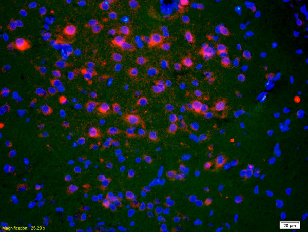 ACTH 1-39 Antibody in Immunohistochemistry (Paraffin) (IHC (P))