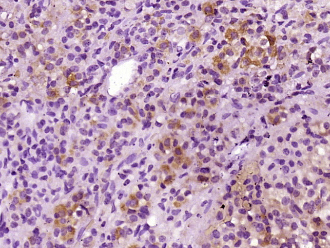 ACTH 1-39 Antibody in Immunohistochemistry (Paraffin) (IHC (P))